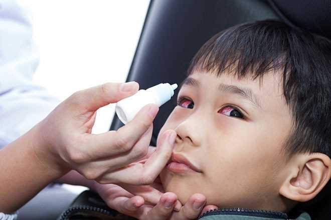 Tiên Phước ghi nhận hơn 1.500 ca bệnh đau mắt đỏ trong trường học
